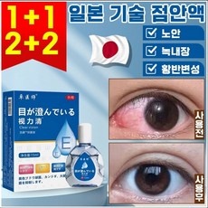최저가 시력교정안약 추천 정보 탑 10
