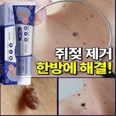 세일 쥐젓제거연고 추천 상품 리스트 10